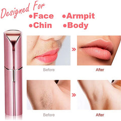 Lip Laser Epilator